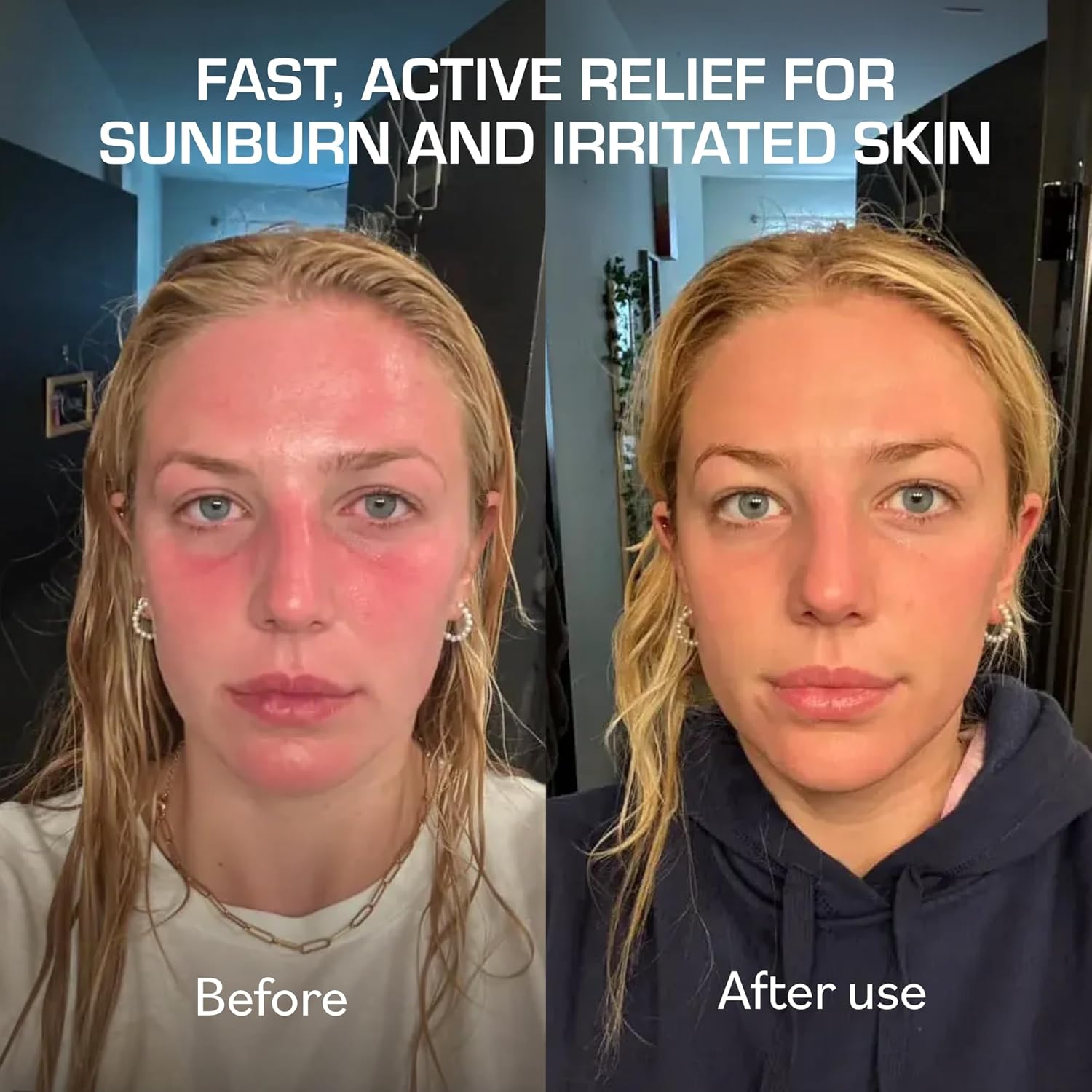 Cooling after-sun gel cream in clear travel bottle, marine bioactive formula with niacinamide and aloe for sunburn relief โ side