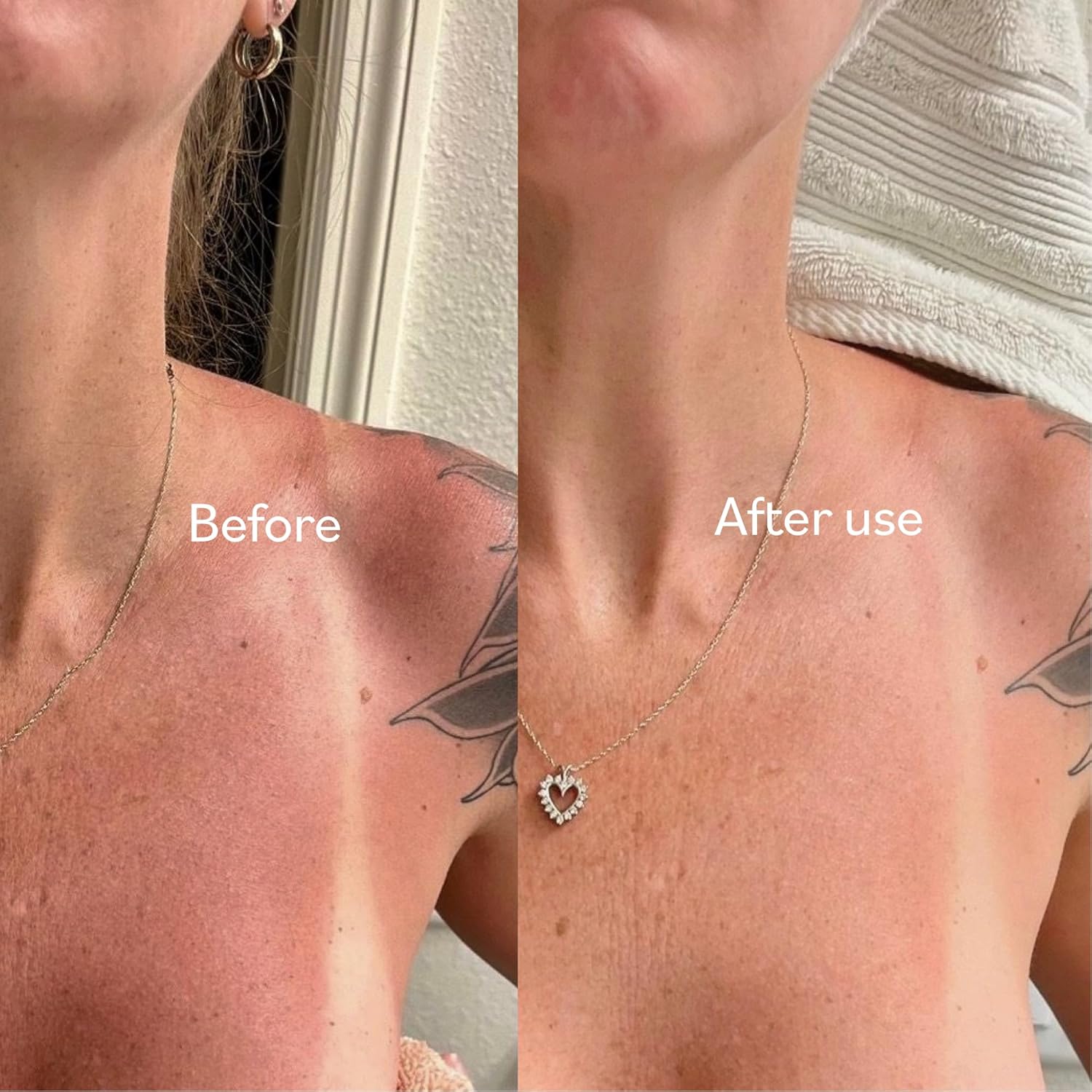 Cooling after-sun gel cream in clear travel bottle, marine bioactive formula with niacinamide and aloe for sunburn relief โ back