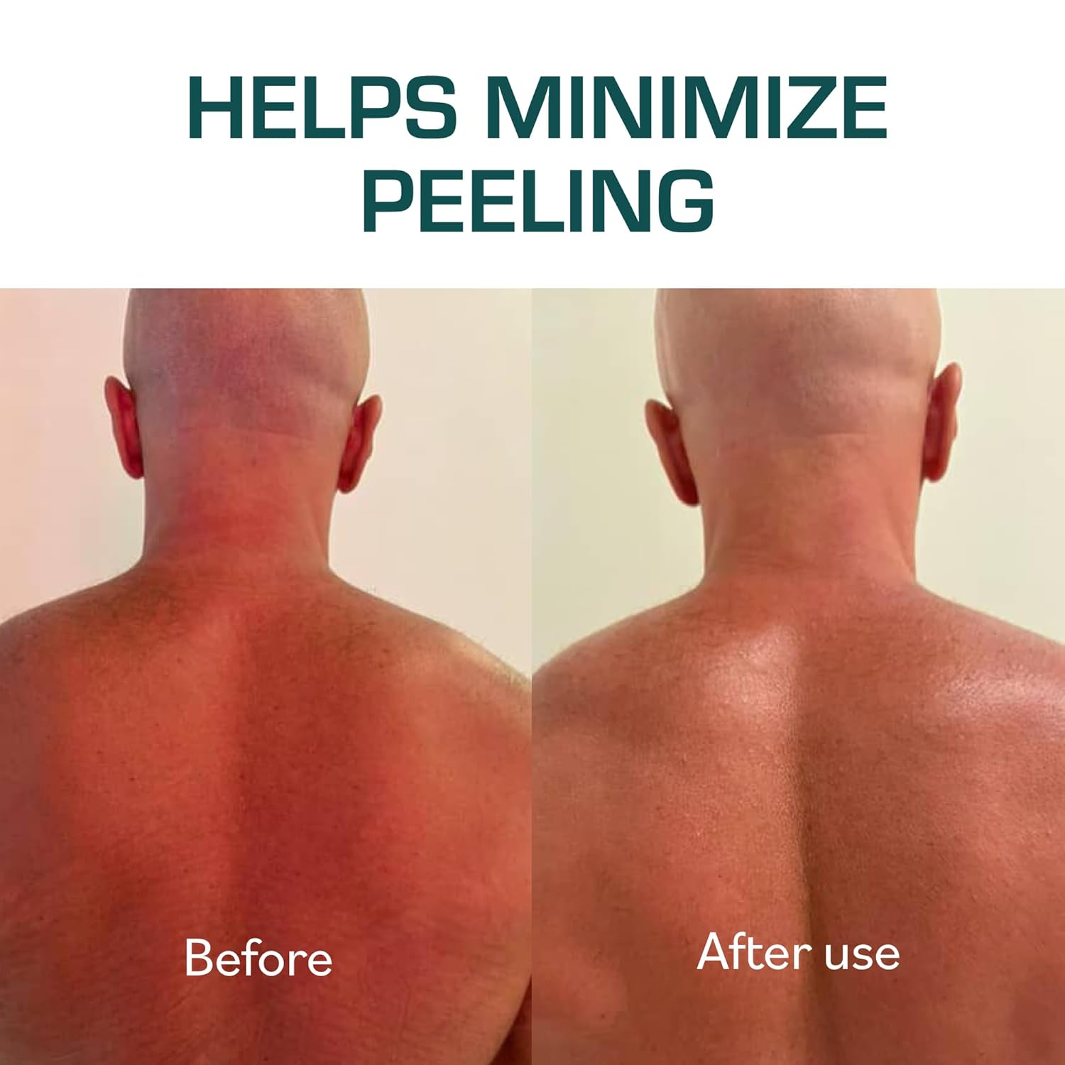 Cooling after-sun gel cream in clear travel bottle, marine bioactive formula with niacinamide and aloe for sunburn relief โ view 4